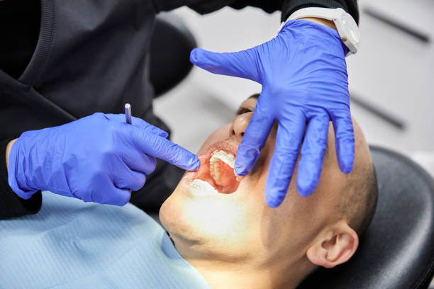 Best Emergency Dental Care for Broken or Chipped Teeth in Hampden Sydney, VA